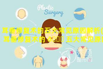 耳垂修复术的五大常见原因解析(耳垂修复术的 🐅 五大常见原因解析图片)